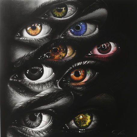 Heterochromia Iridum #4